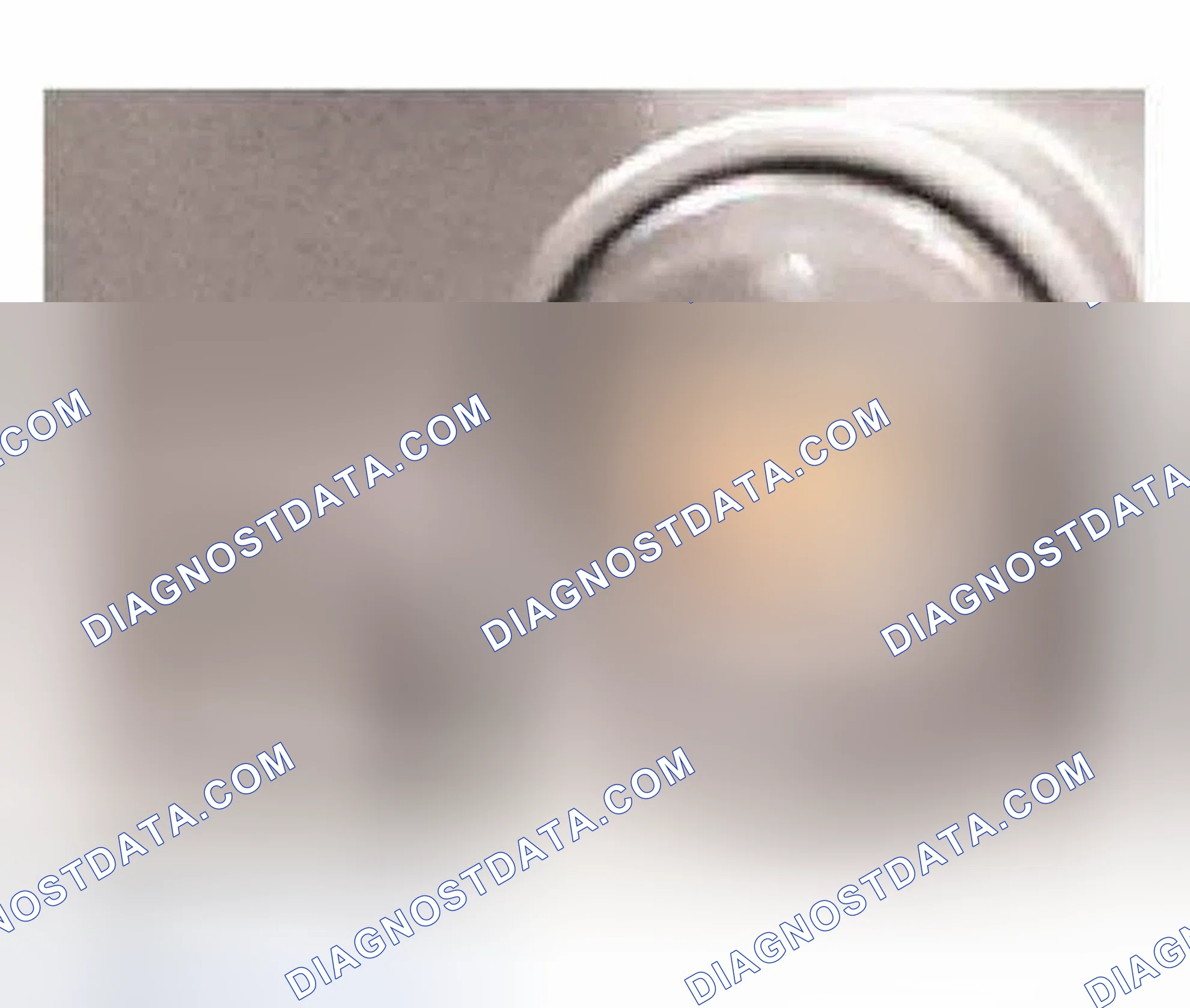 Scheme 44: PDC Button