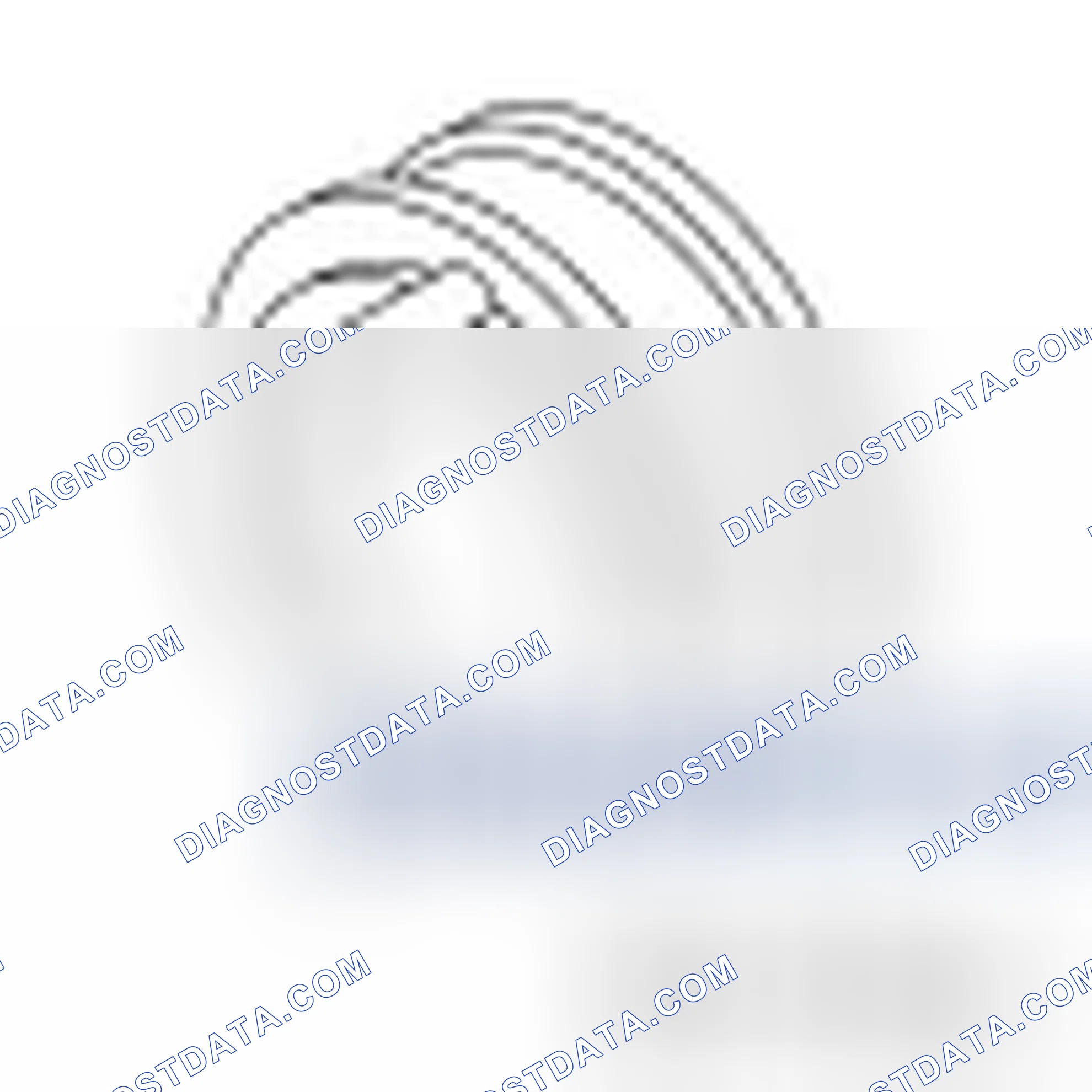 Scheme 15: Camshaft Timing