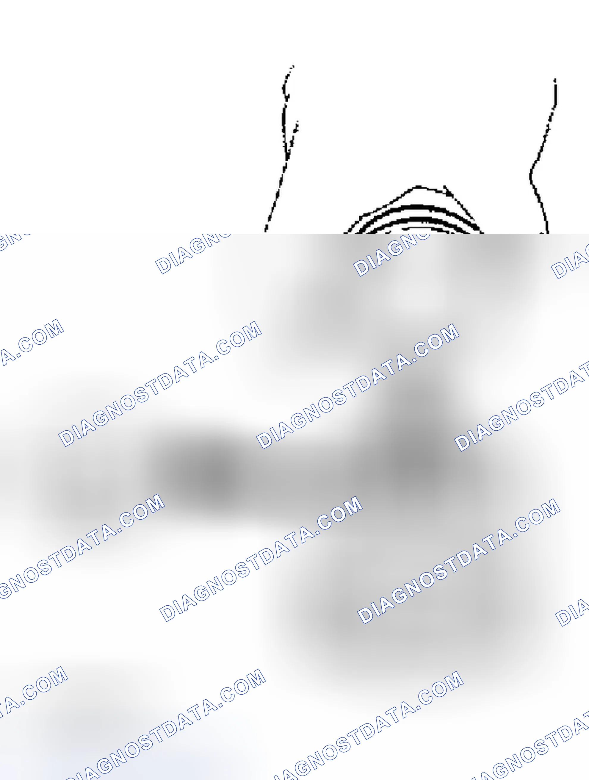 Scheme 120: Piston And Piston Pin Clearance