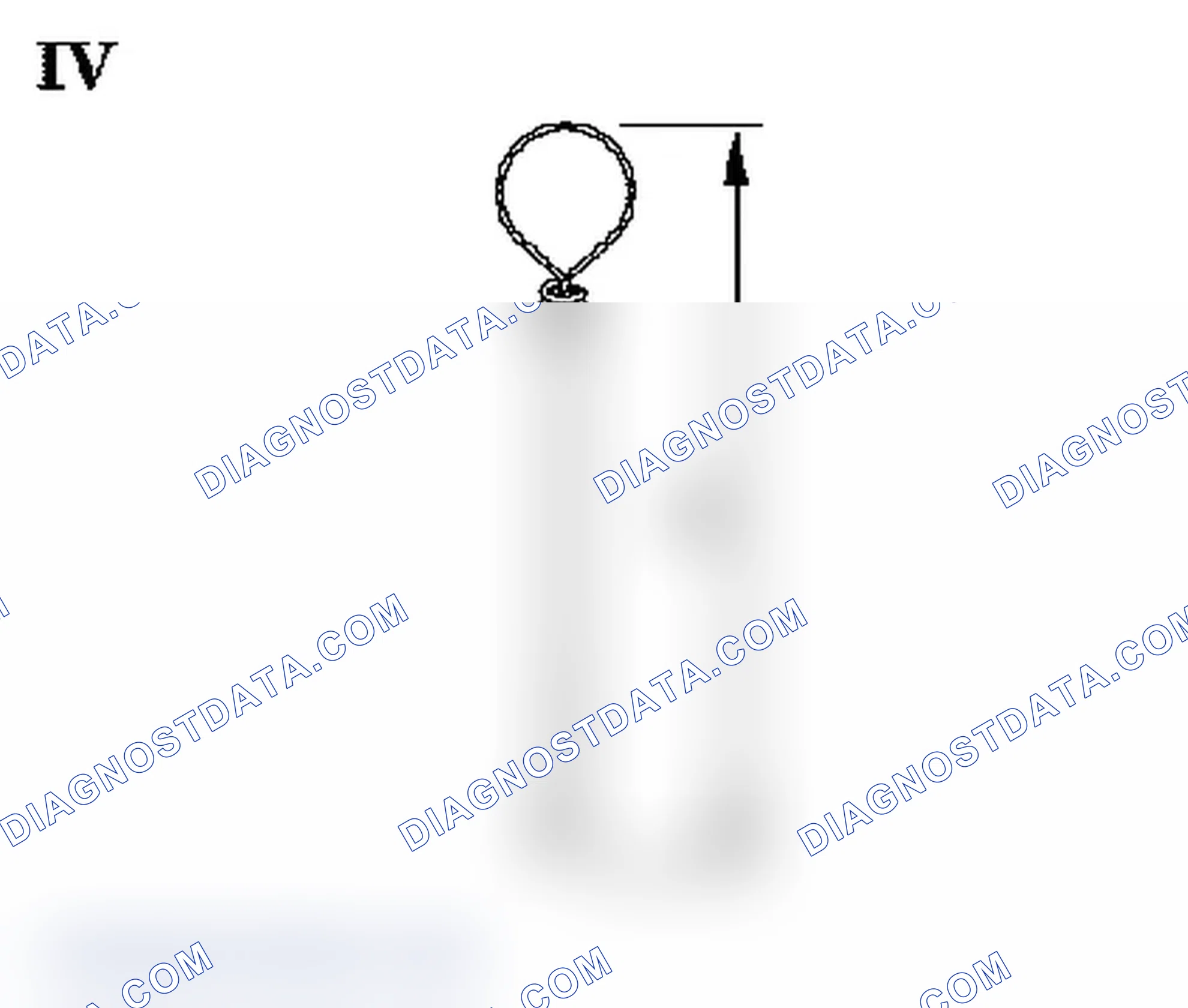 Spring Checkvalve - Remove