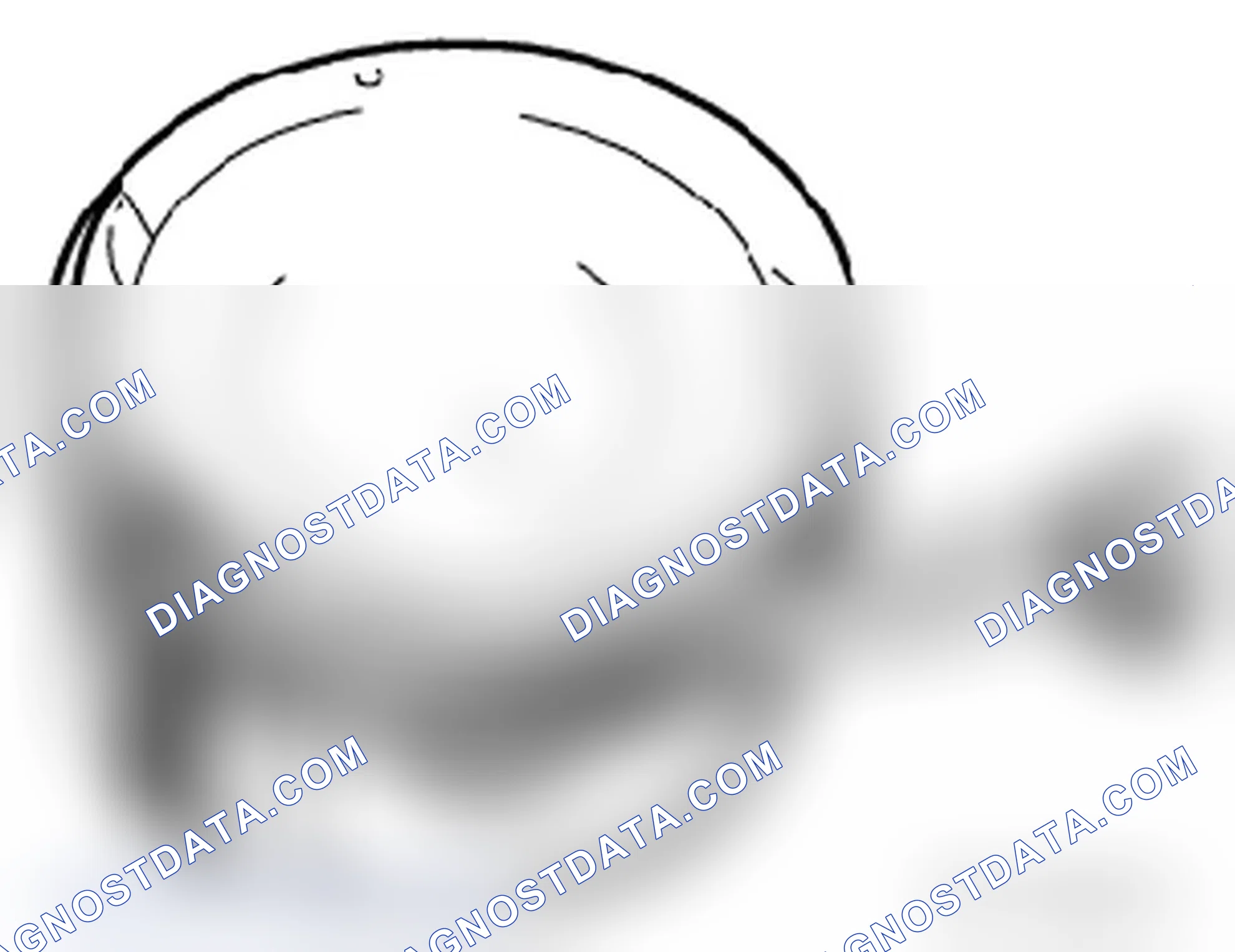 Scheme 35: Piston Ring Measurements