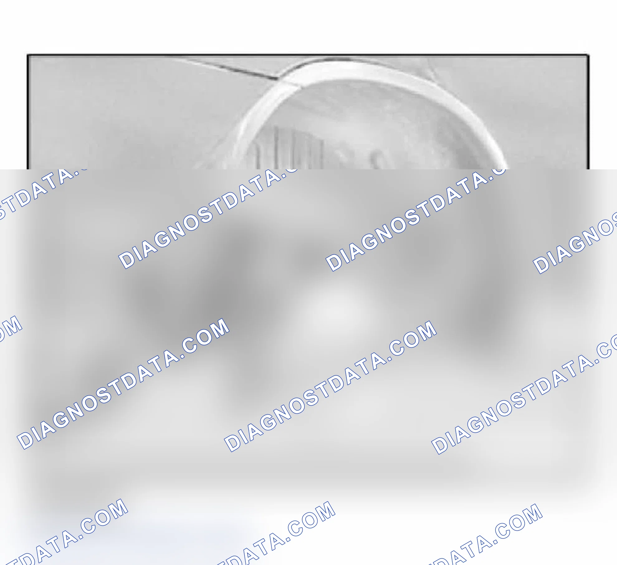 Scheme 113: 16 11 120 Removing and installing / replacing expansion tank for tank ventilation