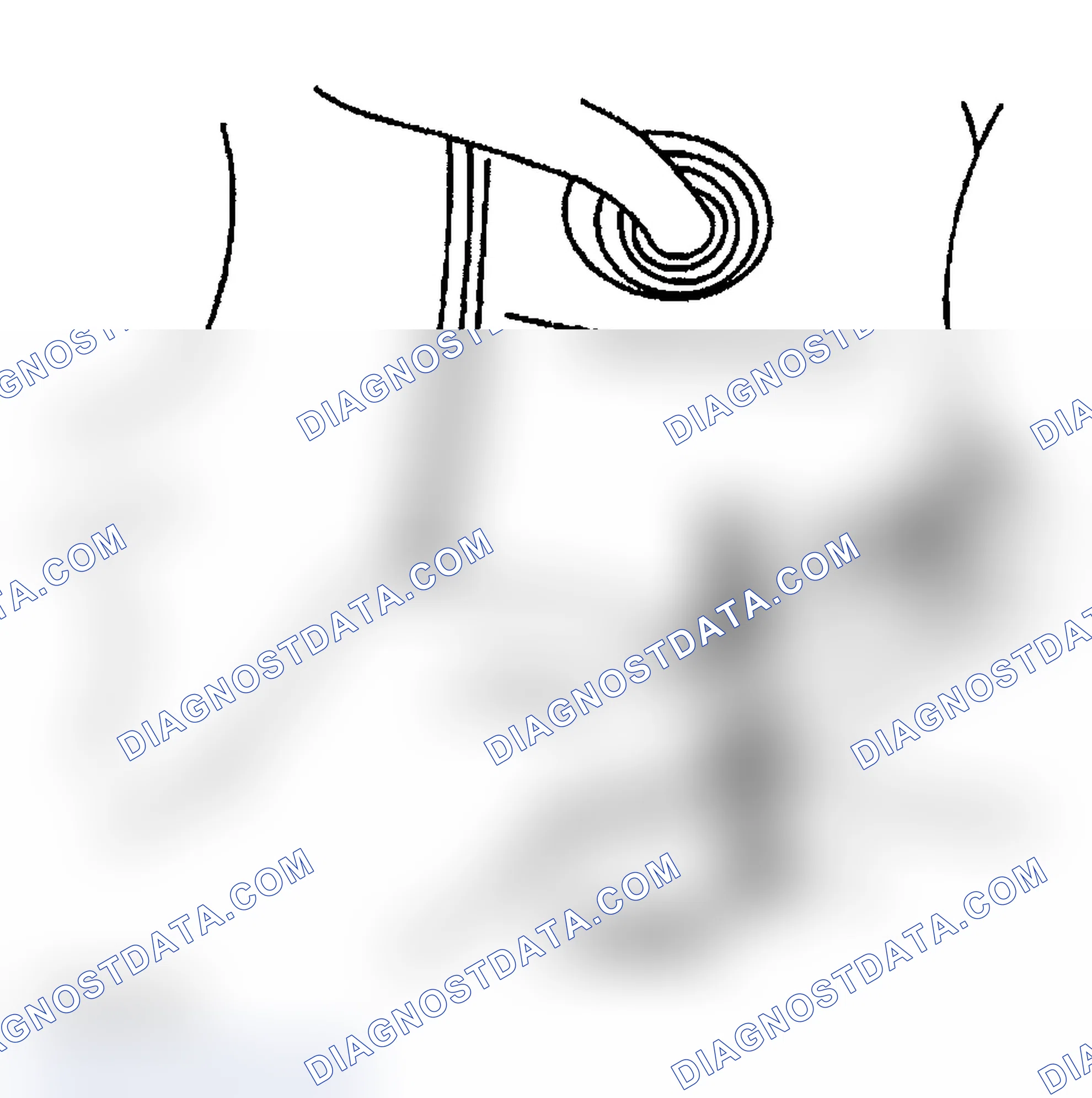 Scheme 25: Removal Procedure