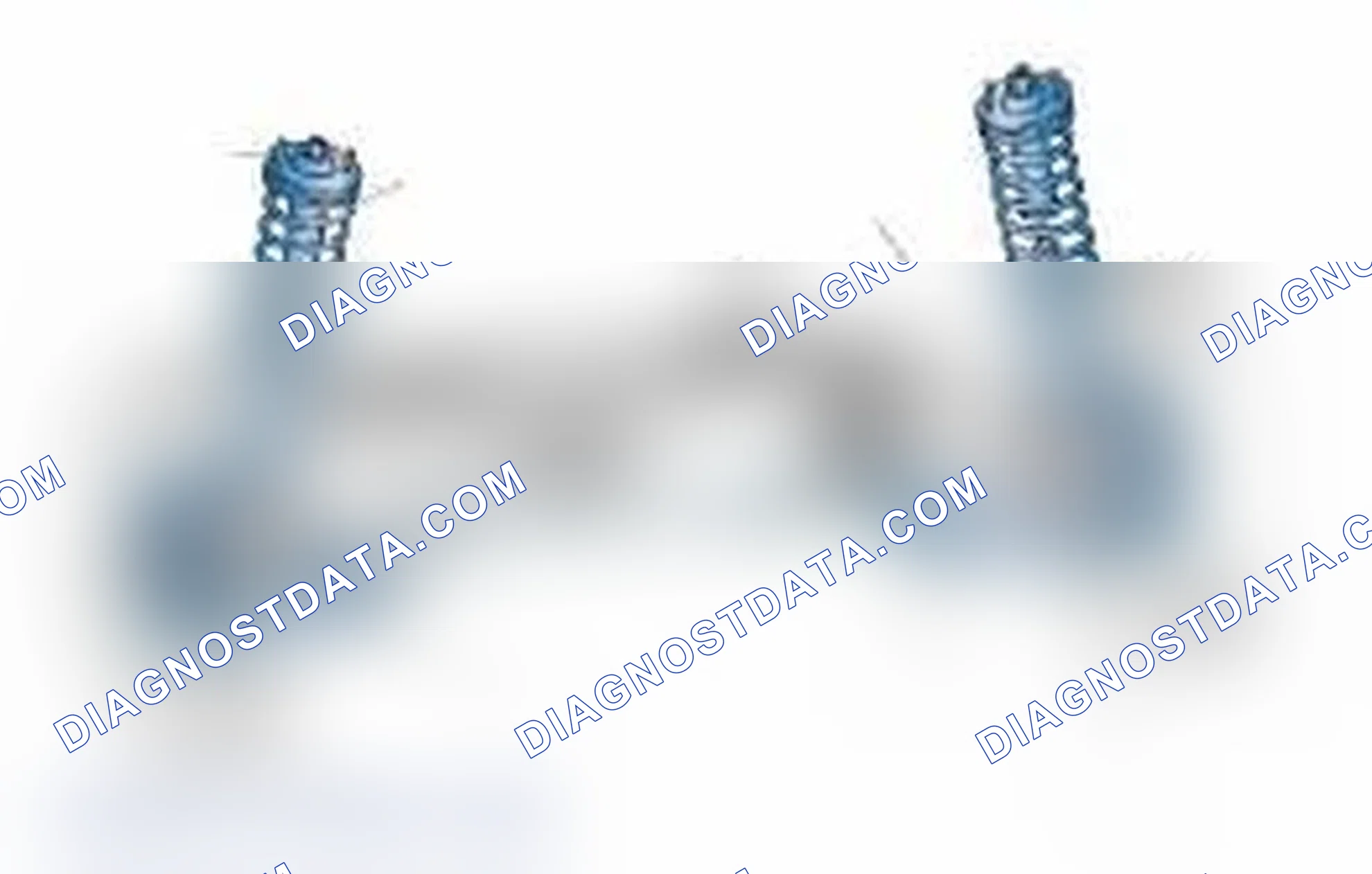Scheme 25: Typical Front Suspension & Steering Components