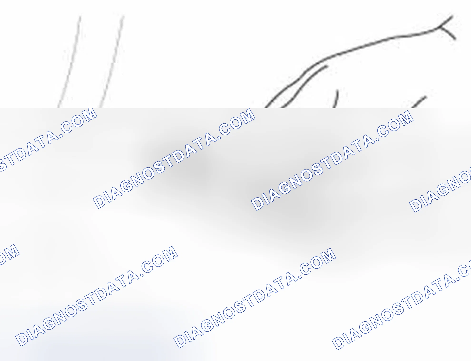 Scheme 9: Inspection