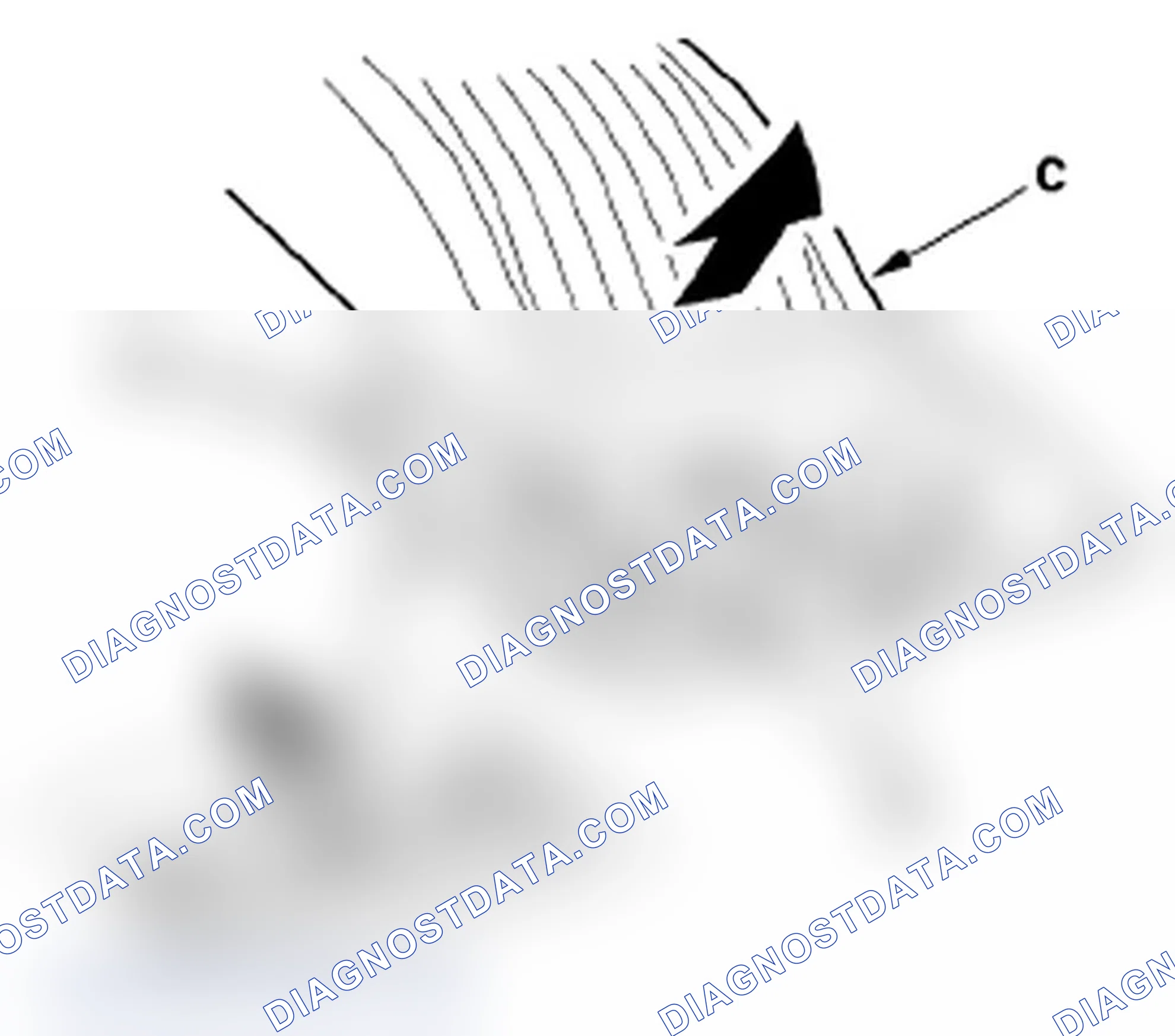 Scheme 34: Carpet Replacement