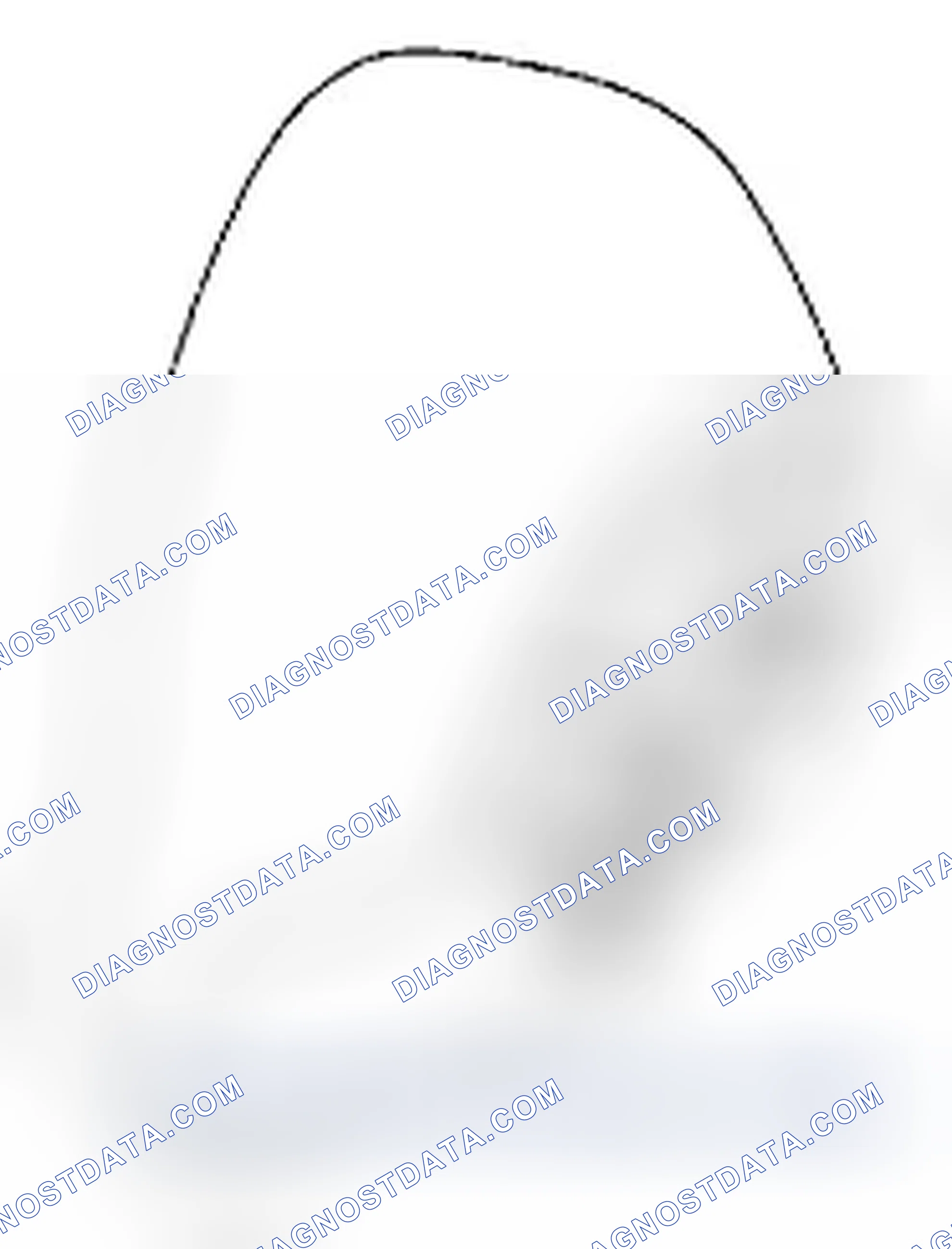 Scheme 1: Driver Air Bag Module Description
