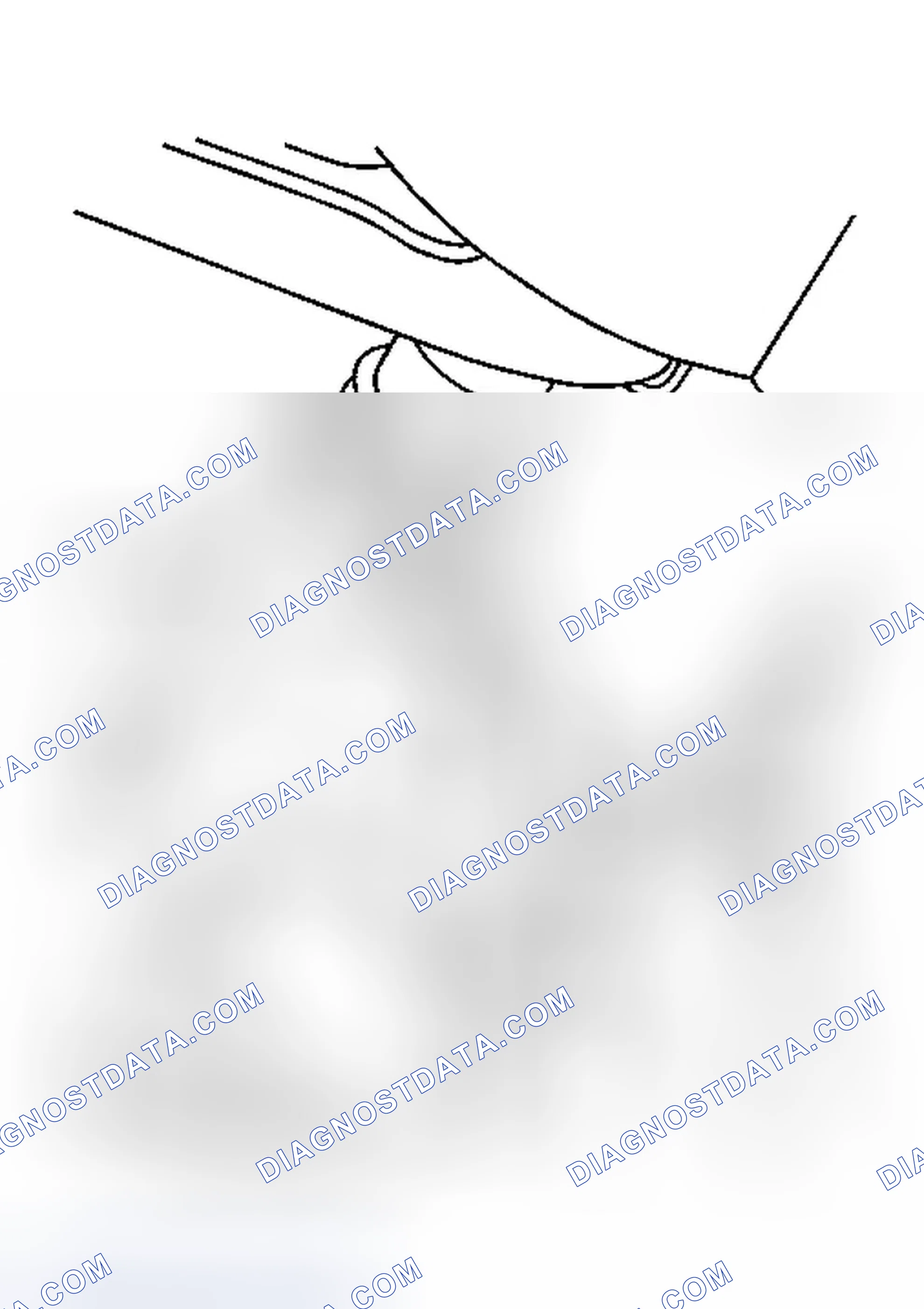 Scheme 12: Installation Procedure