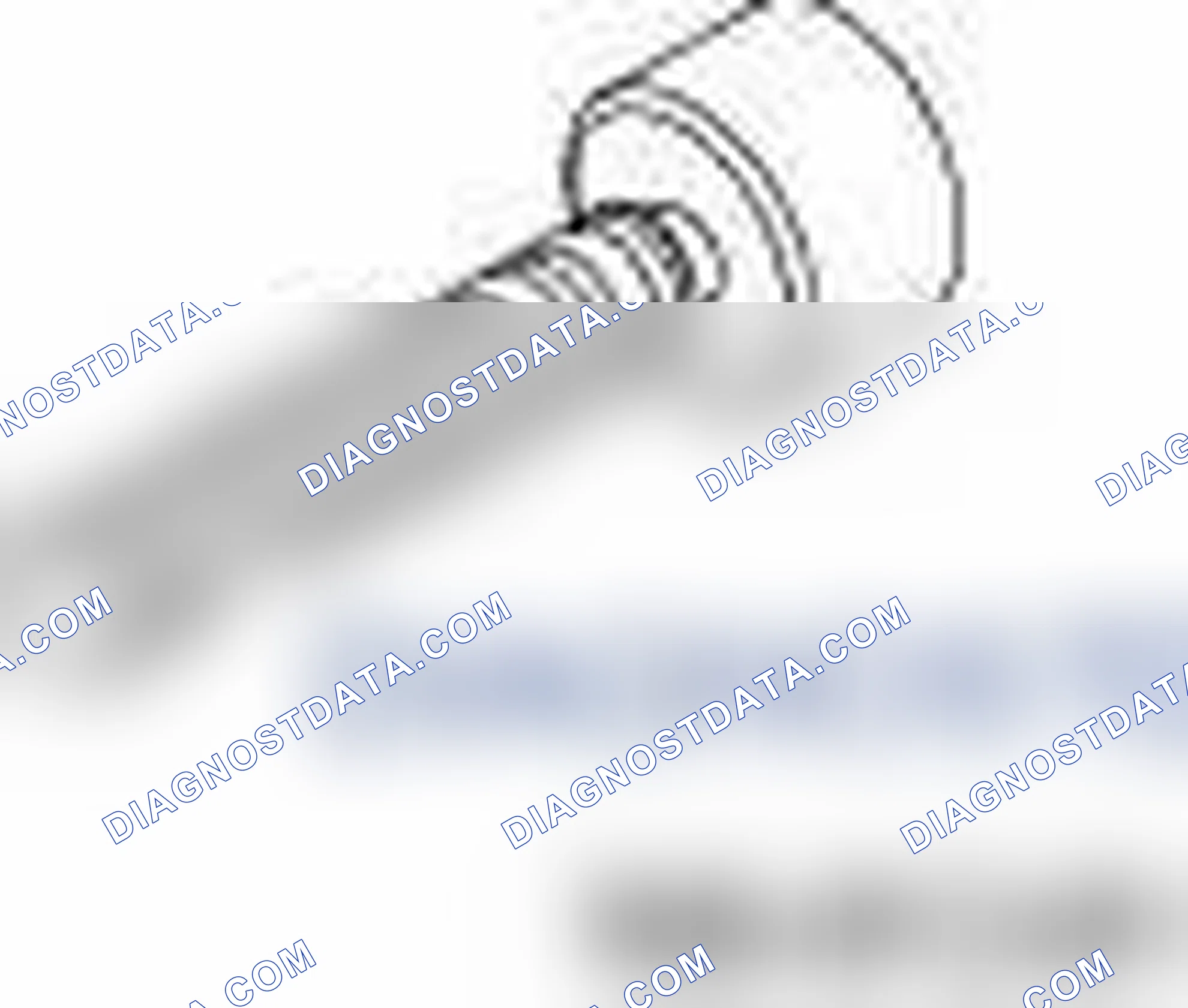 Scheme 6: INPUT SHAFT SEAL