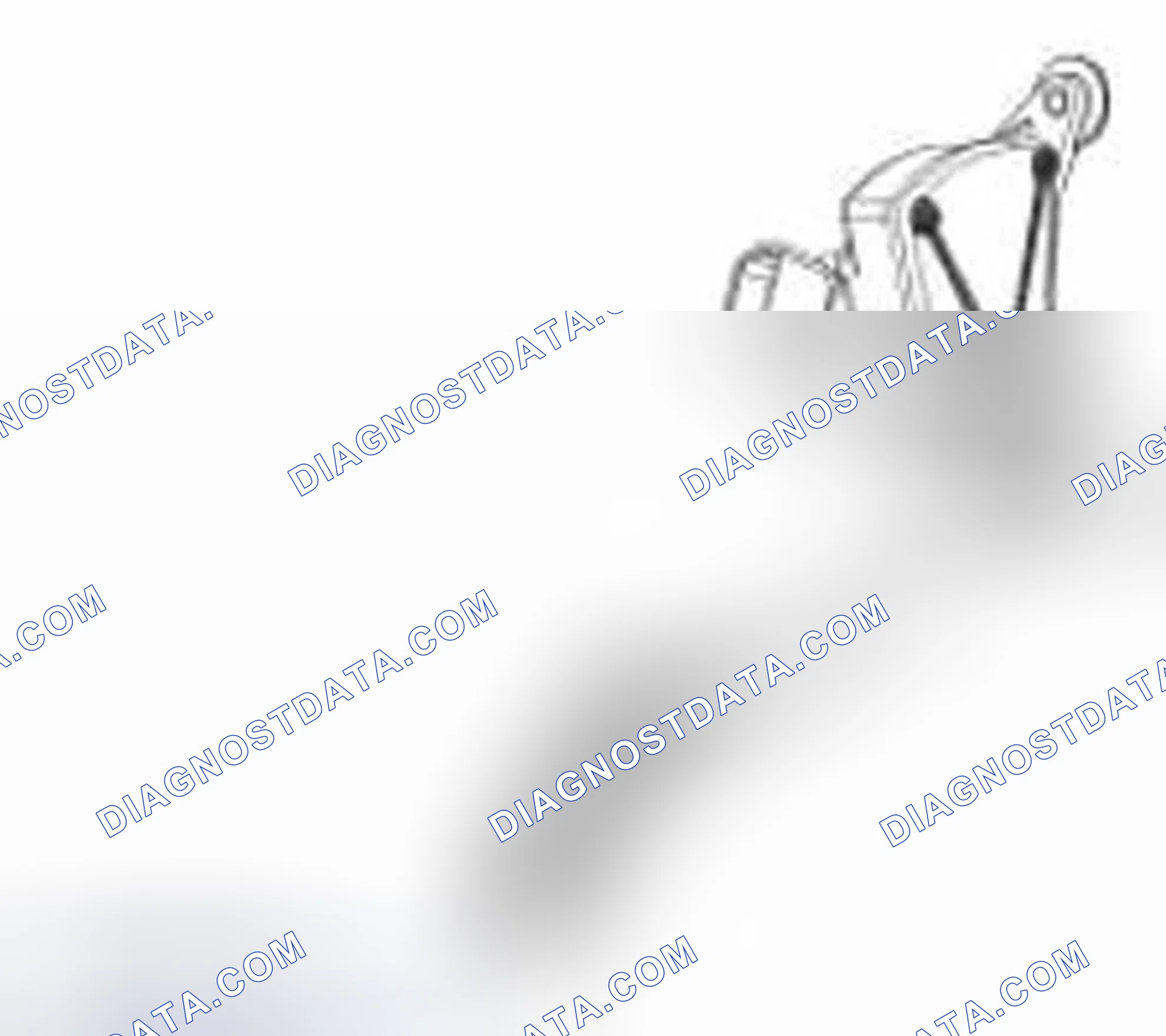 Scheme 23: 3 Track APP Sensor