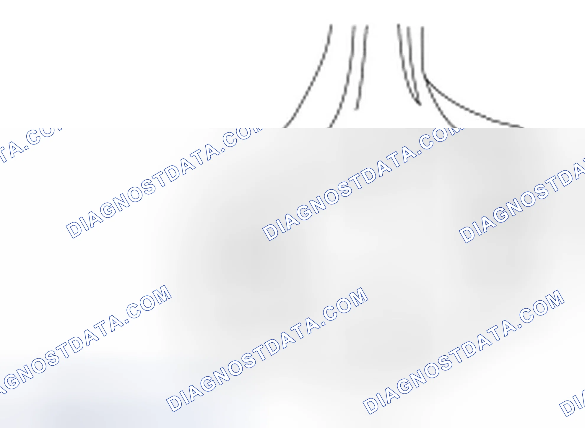 Scheme 536: Connecting Rod Large End Bore