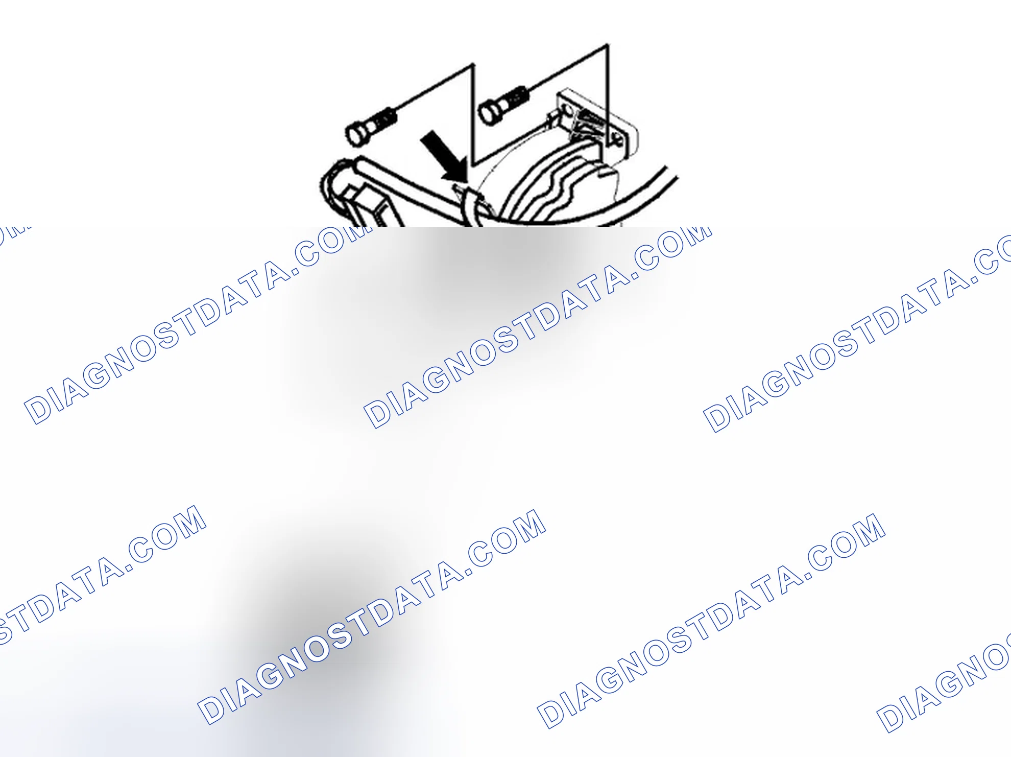 Scheme 263: Removing the accelerator pedal module