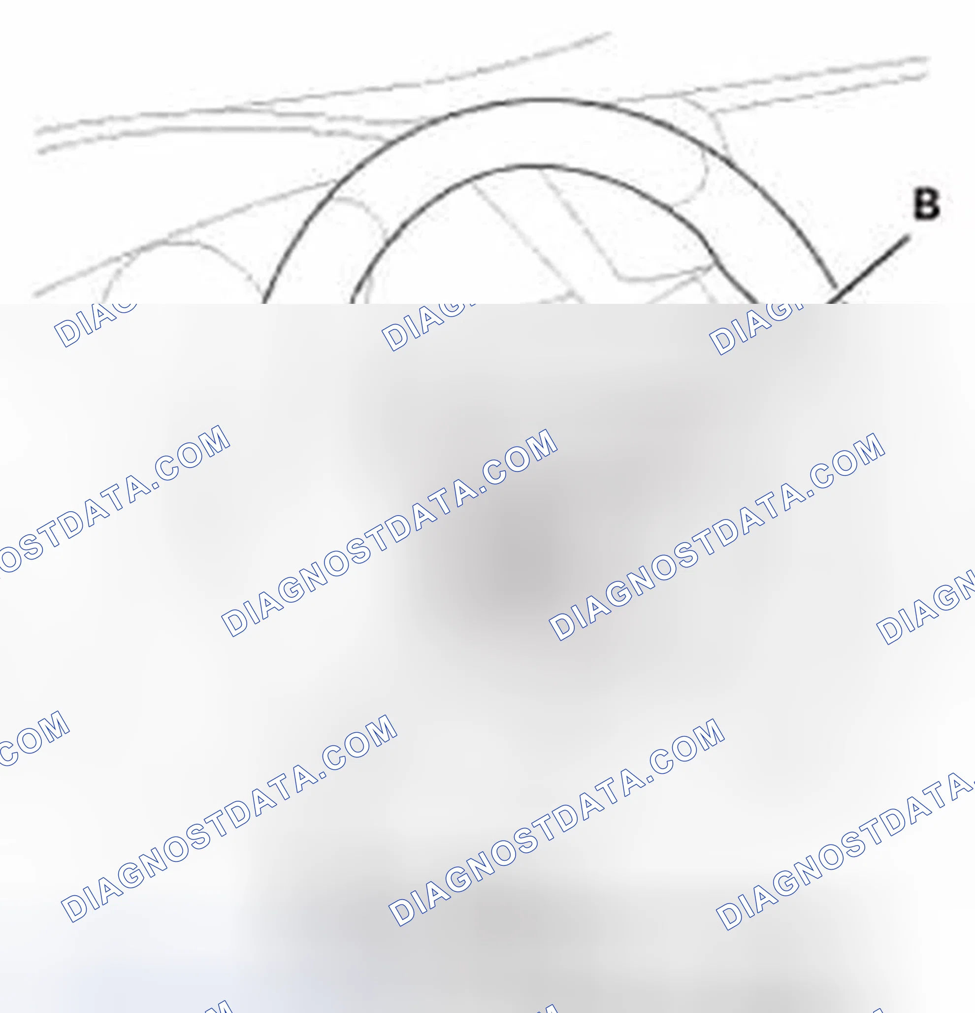 Scheme 887