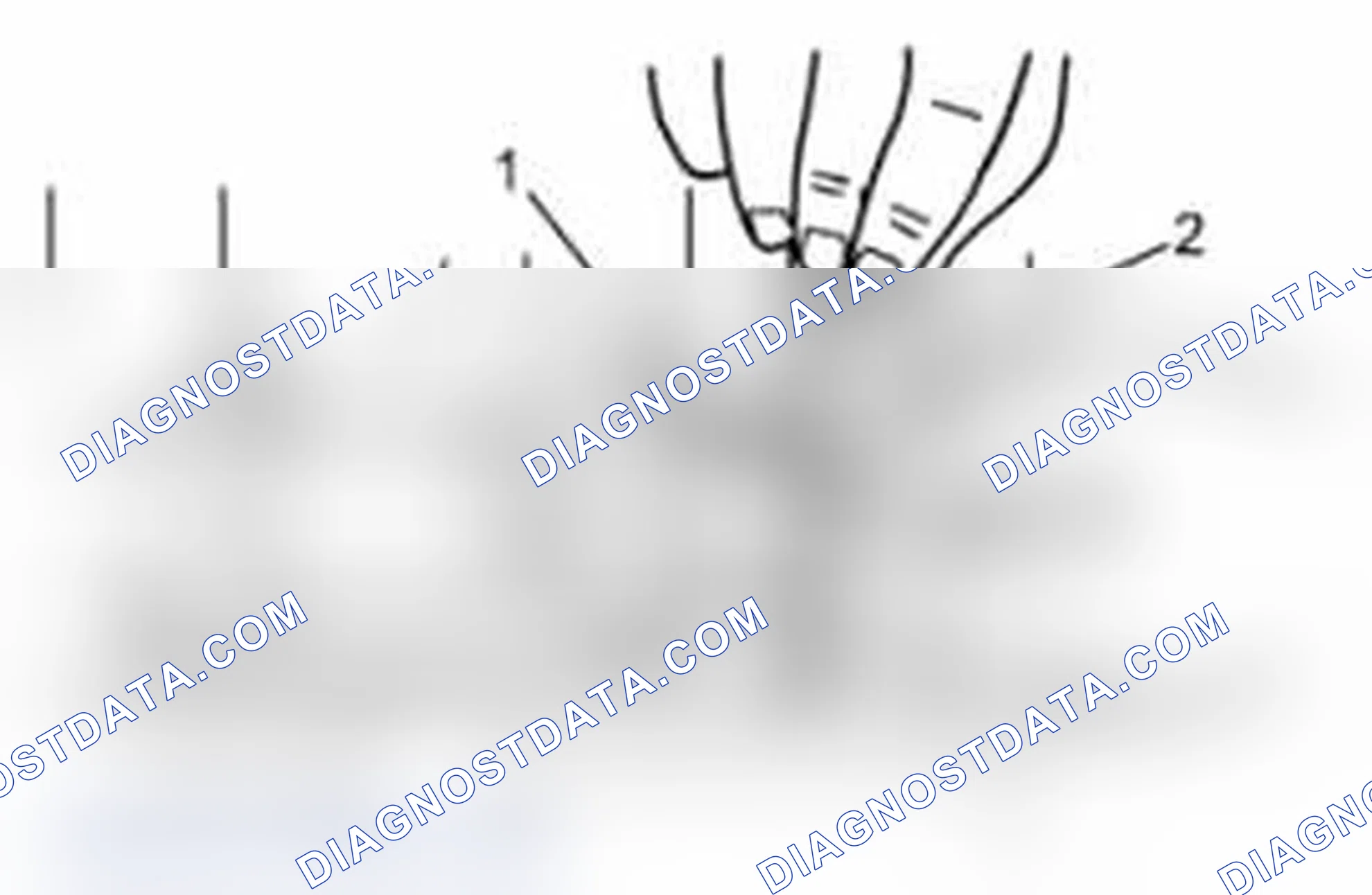Scheme 62: Camshaft Journal Clearance
