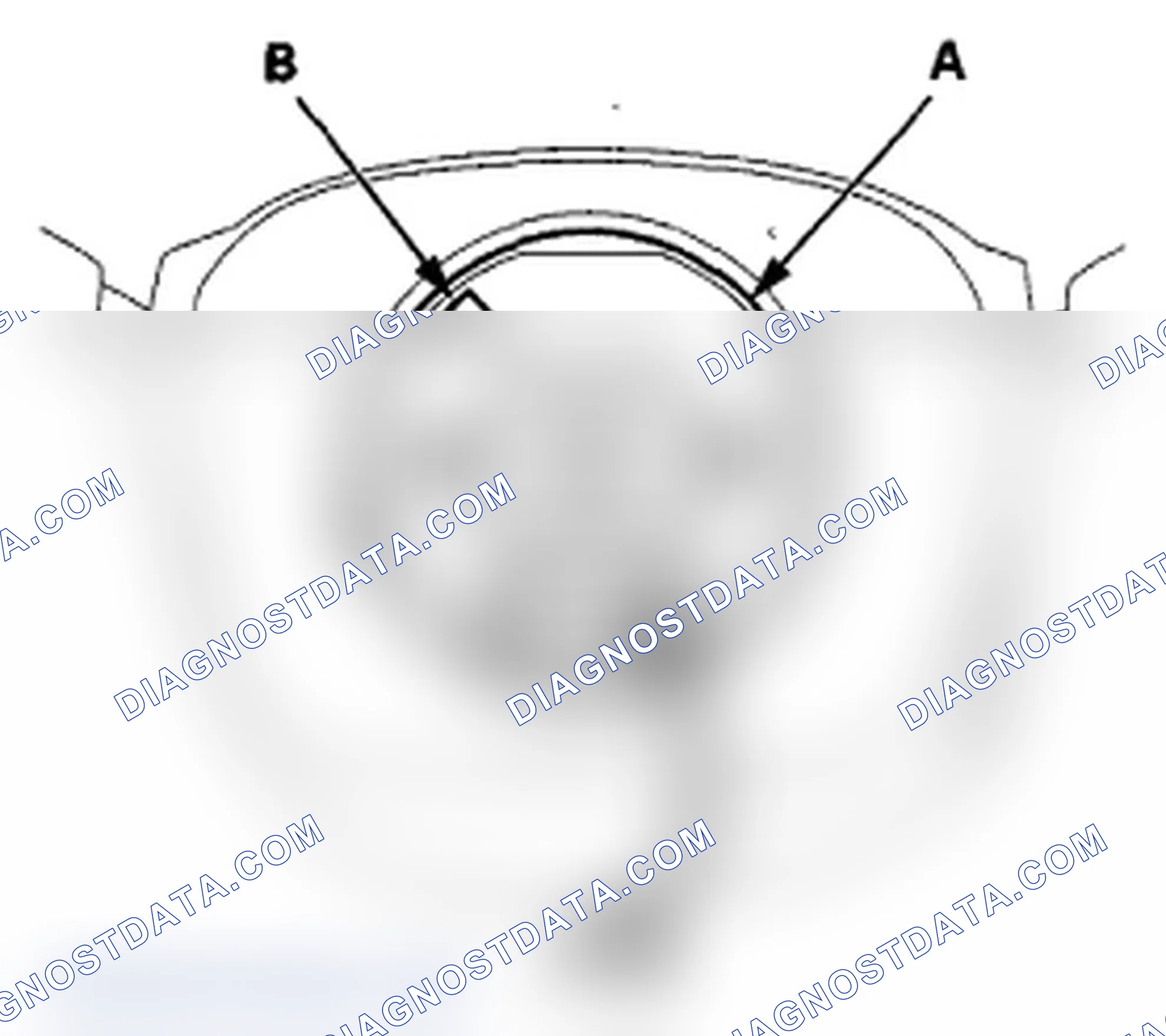 Scheme 10: Steering Wheel Installation